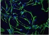Sympozjum The 13th International Symposium "Molecular basis of pathology and therapy in neurological disorders" i The 4th International Conference "Stem cells: therapeutic outlook for nervous system disorders"